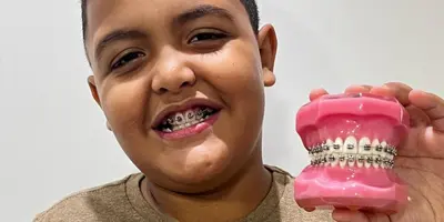 foto Aparelhos Autoligados